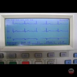 Электрокардиограф Philips M1771A 3