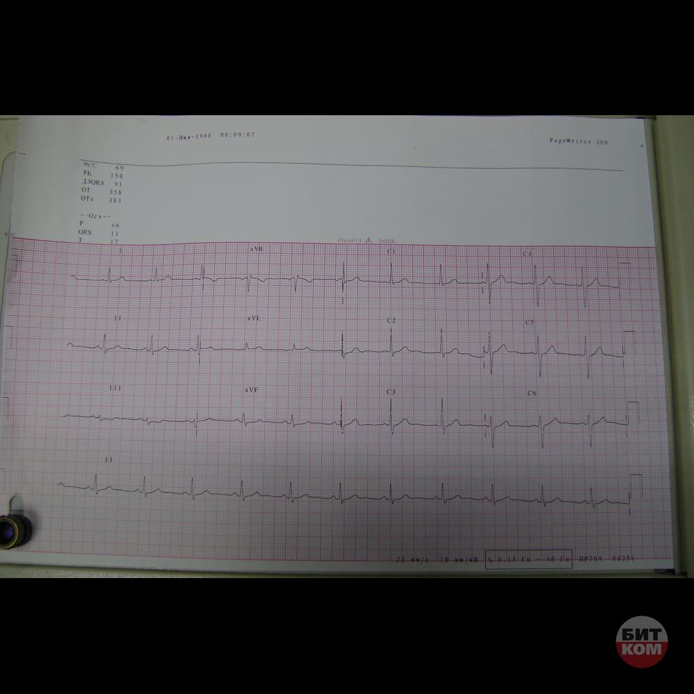 Электрокардиограф Philips M1771A