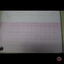 Электрокардиограф Philips M1771A 2