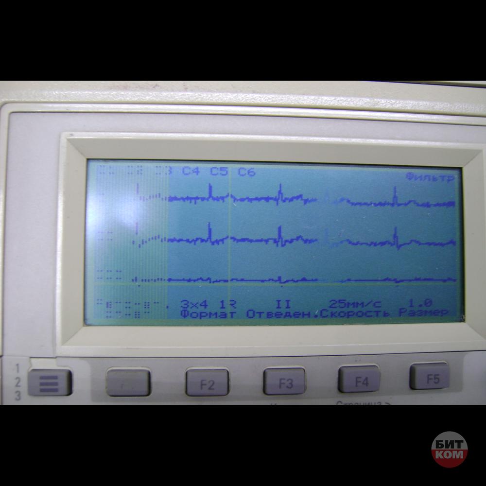 Только кардиограф, без отведений, зажимов и присосок